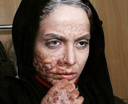 مهناز افشار با گریم ترسناک