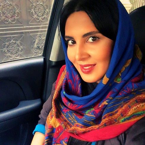 عکس لیلا بلوکات قبل از عمل زیبایی بینی