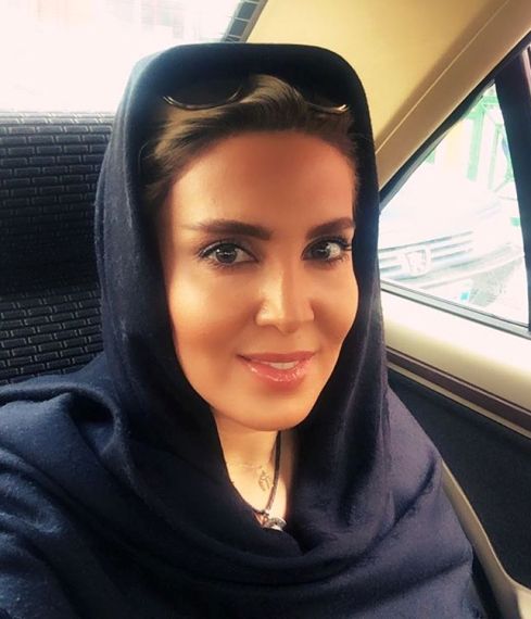 عکس لیلا بلوکات پس از عمل زیبایی بینی