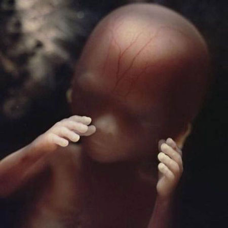 غربالگری جنین چیست؟
