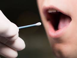 آیا با آزمایش بزاق سرطان دهان قابل تشخیص است؟