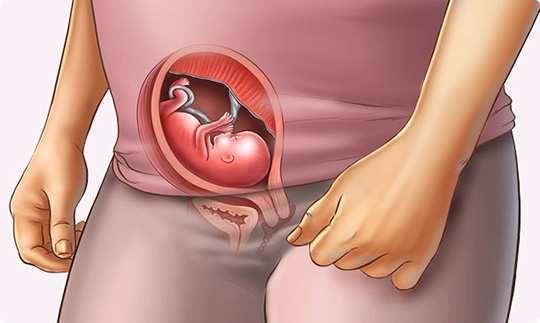 اخم کردن جنین در هفته پانزدهم بارداری