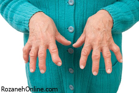 اطلاعات جالب در مورد بیماری آرتریت پسوریاتیک