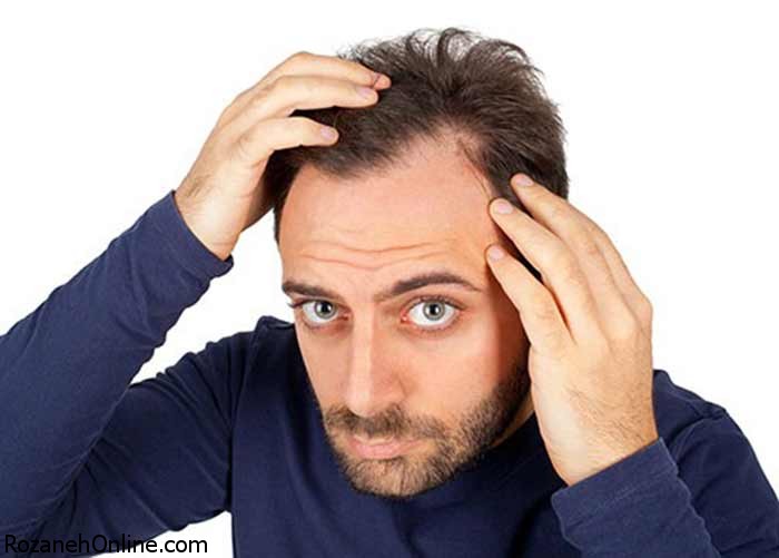 علت ریزش مو مردان چیست؟آیا درمانی وجود دارد یا خیر؟