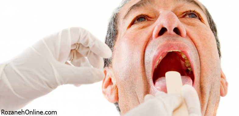 ارتباط بیماری آلزایمر با دندان 