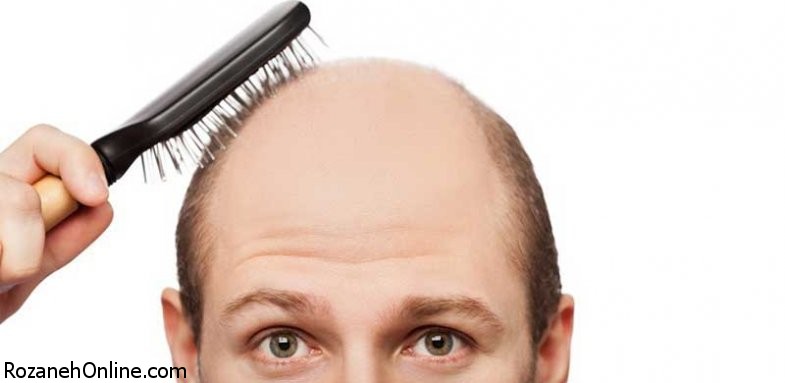 ارتباط ریزش موی زودرس با مشکلات پروستات