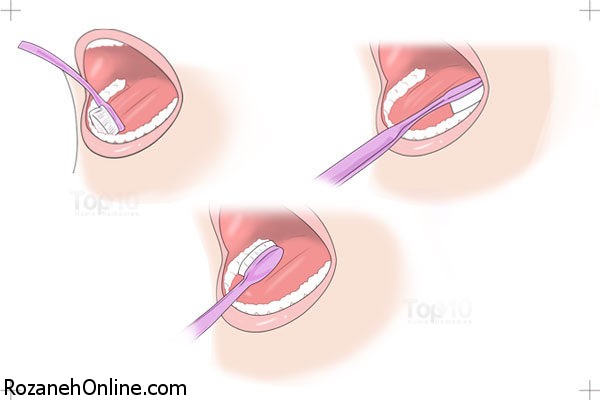 مراحل مسواک زدن صحیح دندان همراه با آموزش تصویری