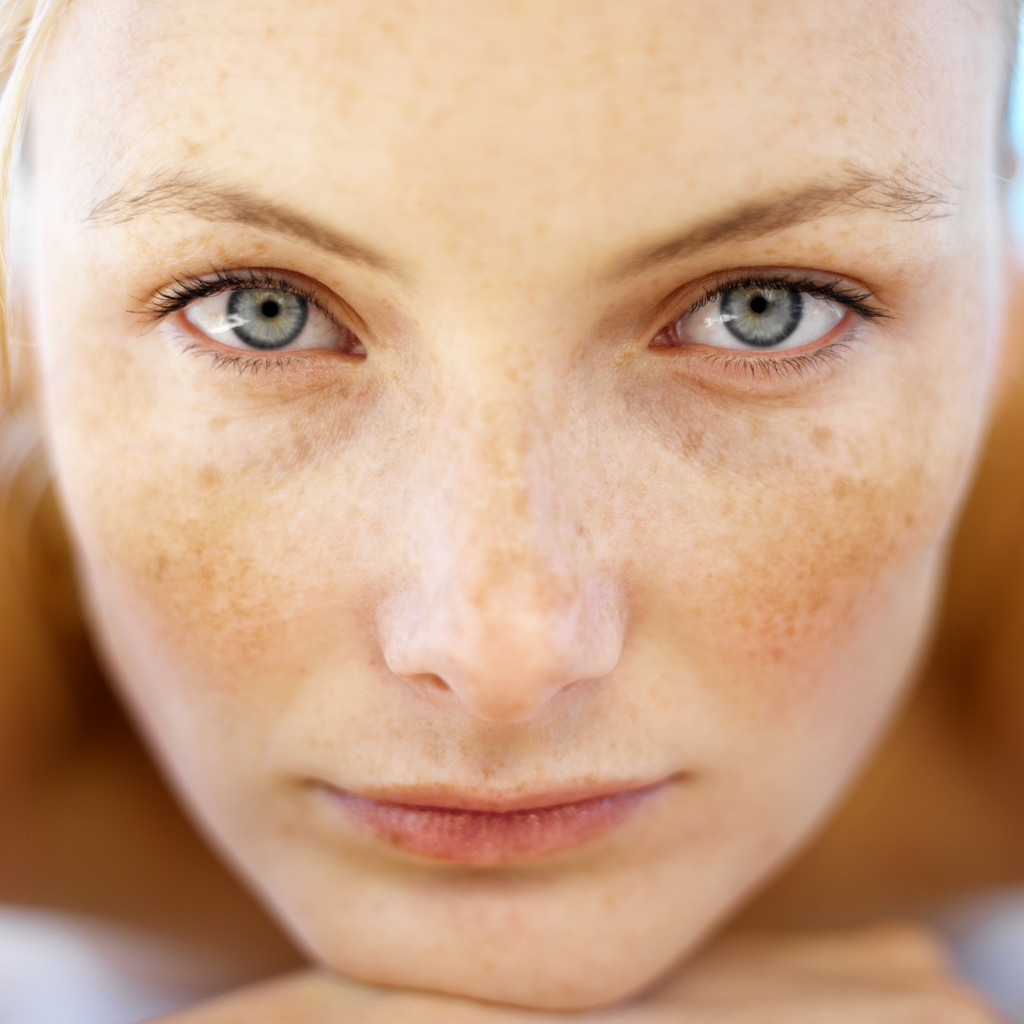 سه ماده طبیعی بسیار مفید برای درمان لکه های پیری پوست