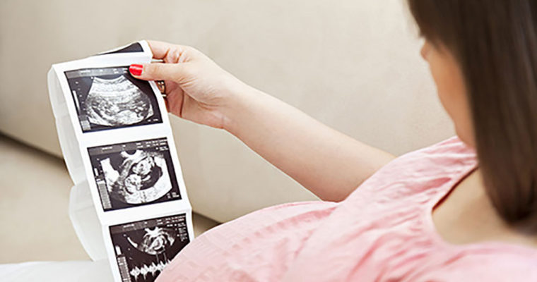 فواید انجام سونوگرافی در بارداری
