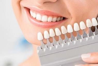 راهنمای جامع لمینت دندان